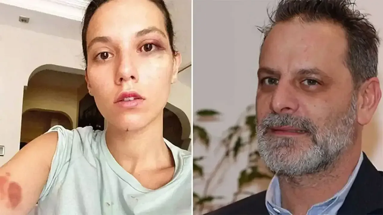 اويونجی اوزان كوون’ه كوتو هابر: زاسي اوناندي، هاپيس ياتاجاك!