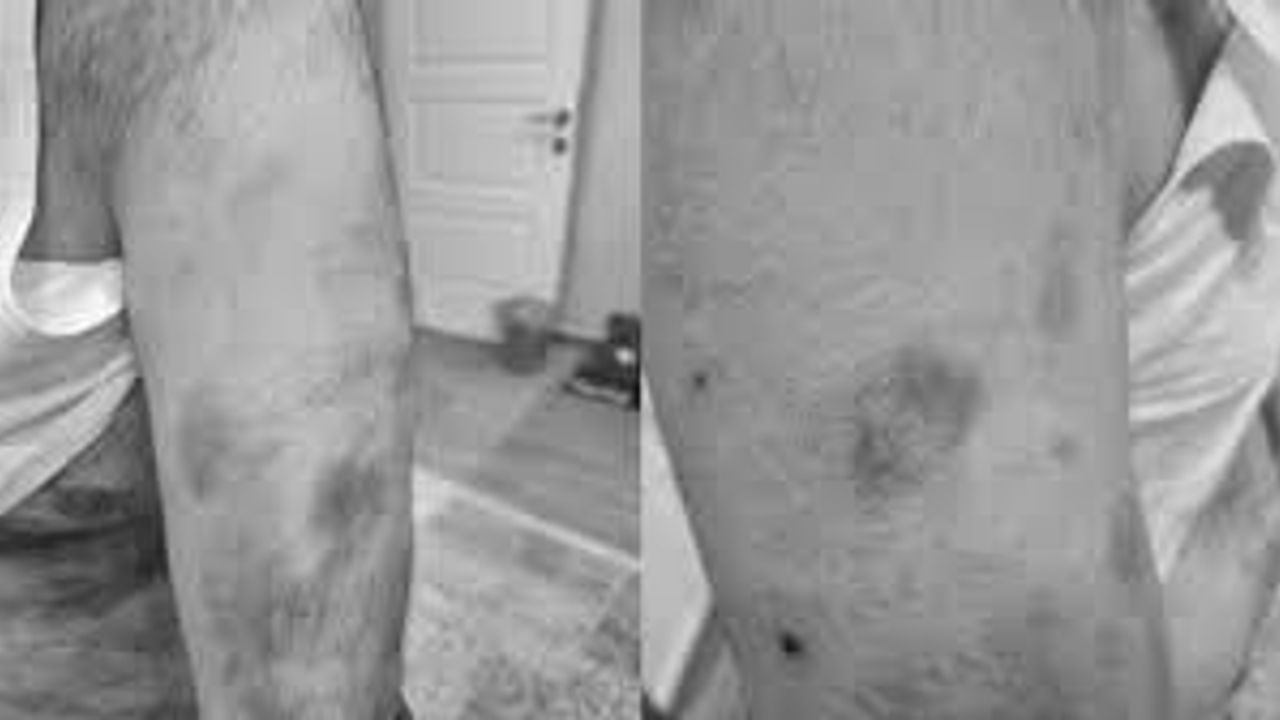 نازه دونوشی دارپ ايديلدي: “چيفت كورويوروم، شيكايتچ‏اییم”