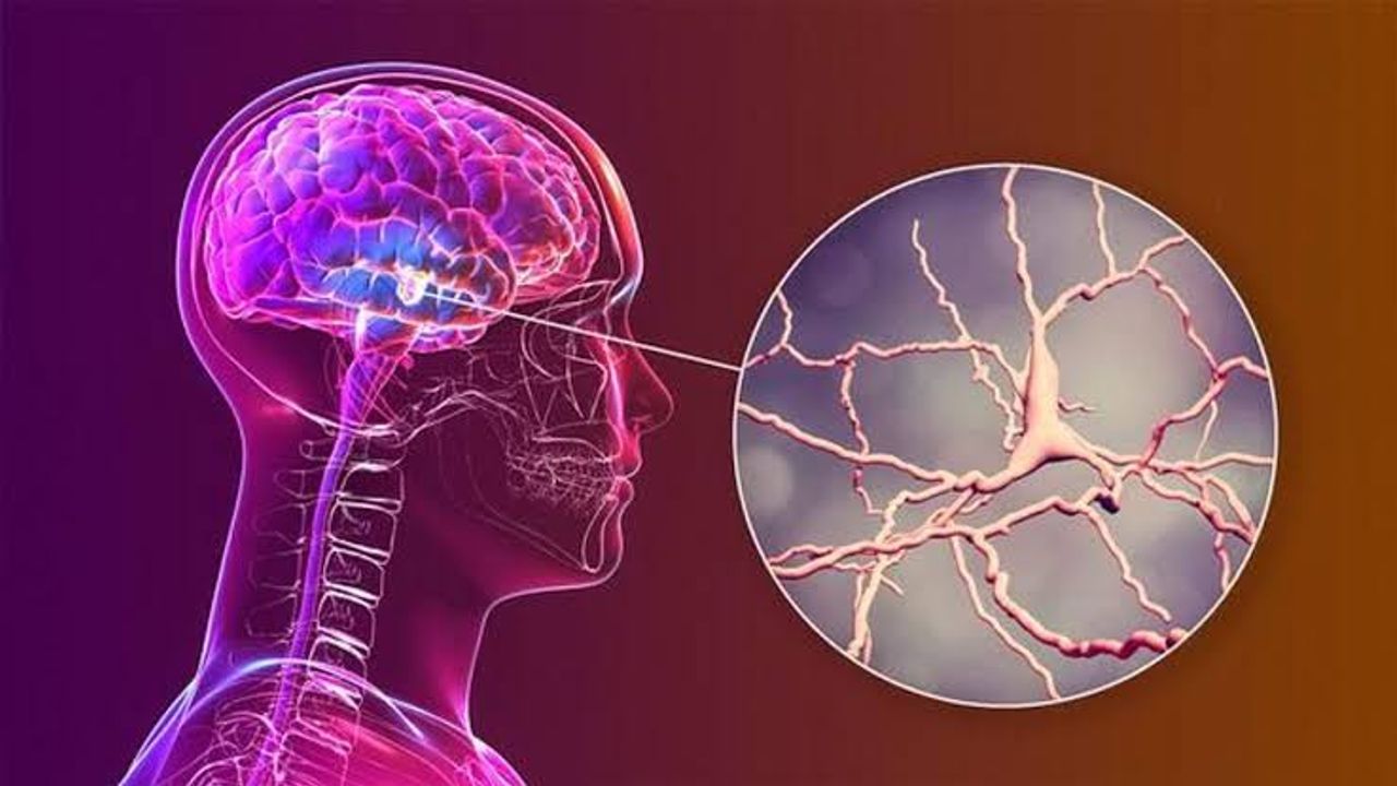 رابەمیسڭ، آلزحەیمر ریسکی طاشییان کیشیلرده بین قان آقیشینی آرتیردی – Rapamisin, Alzheimer riski taşıyan kişilerde beyin kan akışını artırdı