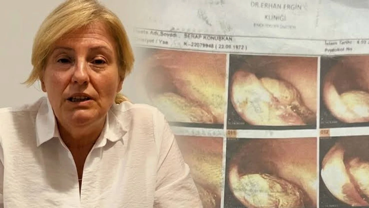 مغنیسادە خستەنڭ باغیرصاغنده یبانجی جسم بولونمسی دعواسیندە ایکی دوقتورڭ یارغیلانلانمسینه باشلانلاندی – Manisa’da hastanın bağırsağında yabancı cisim bulunması davasında iki doktorun yargılanmasına başlandı